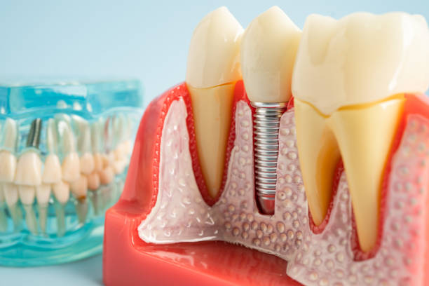 Best Preventive Dentistry  in Hunter, TN